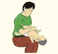 Figure of cardiopulmonary resuscitation in baby/infant