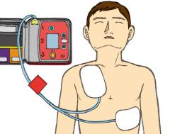 Figure of the position where the pad is attached