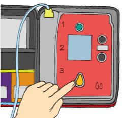 Figure of pushing the shock button