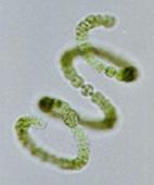 Image of anabena (odorizing organism)